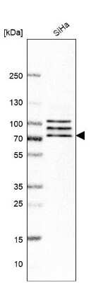 Western Blot: CNOT4 Antibody [NBP1-84439]