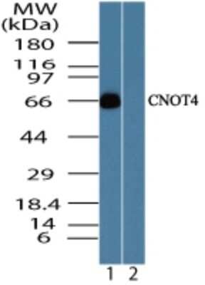 Western Blot: CNOT4 Antibody [NBP2-24527]