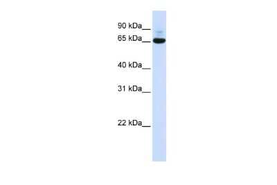 Western Blot: CNOT4 Antibody [NBP3-10321]