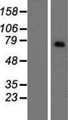 Western Blot: CNOT4 Overexpression Lysate [NBP2-07425]