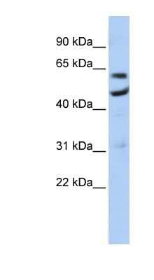 Western Blot: CNOT6 Antibody [NBP1-57550]