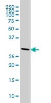 Western Blot: CNOT7 Antibody (2F6) [H00029883-M01]
