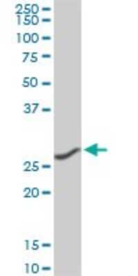 Western Blot: CNOT7 Antibody (2F6) [H00029883-M01]