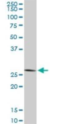 Western Blot: CNOT7 Antibody (2F6) [H00029883-M01]