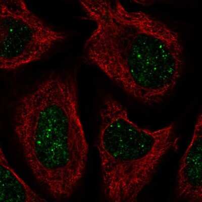 Immunocytochemistry/ Immunofluorescence: CNOT7 Antibody [NBP2-57301]