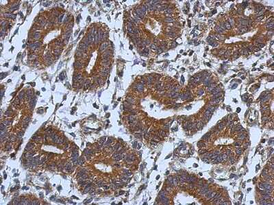 Immunohistochemistry-Paraffin: CNOT7 Antibody [NBP2-15929]