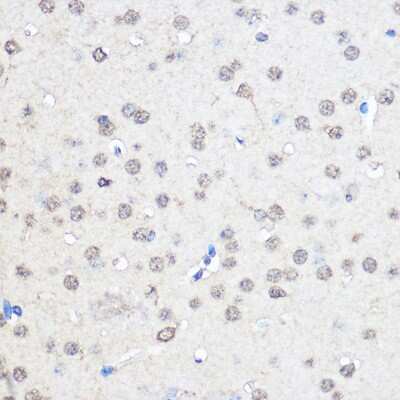 Immunohistochemistry-Paraffin: CNOT7 Antibody - Azide and BSA Free [NBP2-92571]