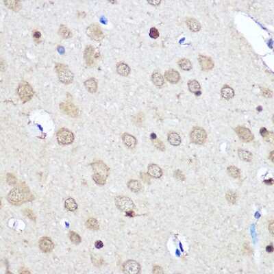 Immunohistochemistry-Paraffin: CNOT7 Antibody - Azide and BSA Free [NBP2-92571]