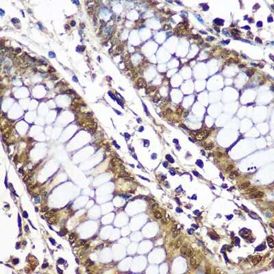 Immunohistochemistry-Paraffin: CNOT7 Antibody - Azide and BSA Free [NBP2-92571]