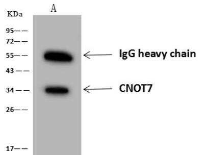 Immunoprecipitation: CNOT7 Antibody [NBP3-12705]