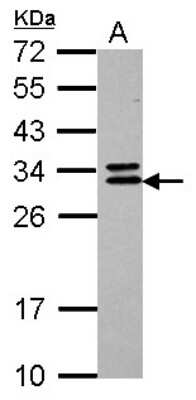 Western Blot: CNOT7 Antibody [NBP2-15929]