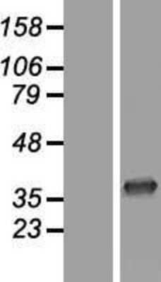 Western Blot: CNOT7 Overexpression Lysate [NBL1-09320]