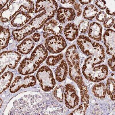 Immunohistochemistry-Paraffin: CNOT8 Antibody [NBP2-13849]