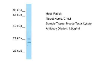 Western Blot: CNOT8 Antibody [NBP1-98337]