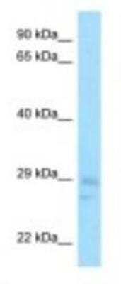 Western Blot: CNOT8 Antibody [NBP1-98338]