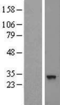 Western Blot: CNOT8 Overexpression Lysate [NBL1-09321]