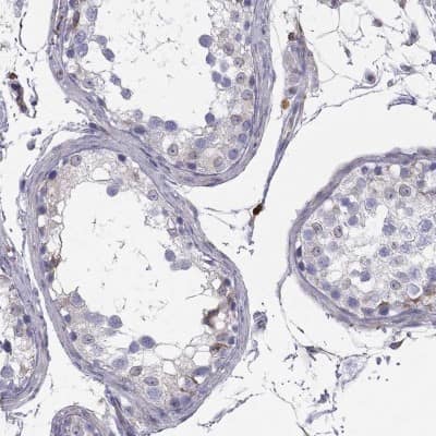 Immunohistochemistry-Paraffin: CNOX Antibody [NBP1-88152]
