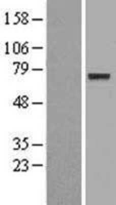 Western Blot: CNOX Overexpression Lysate [NBL1-10271]