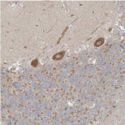 Immunohistochemistry-Paraffin: CNP/NPPC Antibody [NBP1-90623]