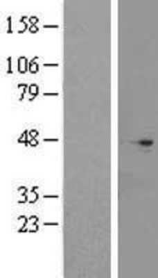 Western Blot: CNPPD1 Overexpression Lysate [NBL1-08405]