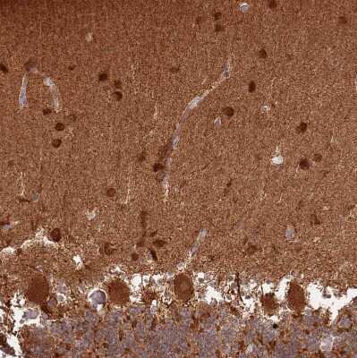 Immunohistochemistry-Paraffin: CNPY1 Antibody [NBP1-94188]