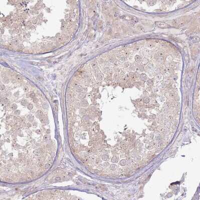 Immunohistochemistry-Paraffin: CNPY1 Antibody [NBP1-94188]