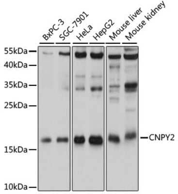 Western Blot: CNPY2 AntibodyAzide and BSA Free [NBP2-92062]