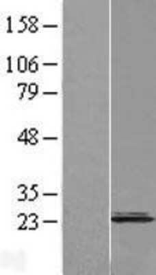 Western Blot: CNPY2 Overexpression Lysate [NBL1-09323]