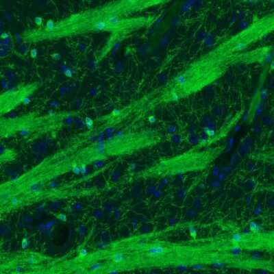 Immunohistochemistry: CNPase Antibody (CL2872) [NBP2-46636]