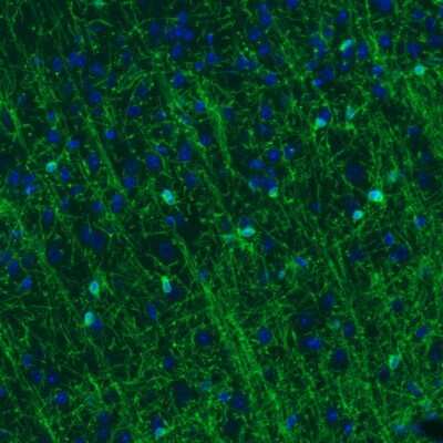 Immunohistochemistry: CNPase Antibody (CL2872) [NBP2-46636]