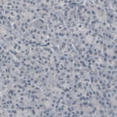 Immunohistochemistry-Paraffin: CNPase Antibody (CL2872) [NBP2-46636]