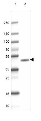 Western Blot: CNPase Antibody (CL2872) [NBP2-46636]