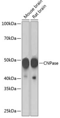 Western Blot: CNPase Antibody (8O3B6) [NBP3-15622]