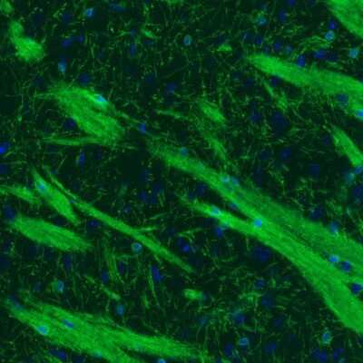 Immunohistochemistry: CNPase Antibody (CL2871) [NBP2-46635]