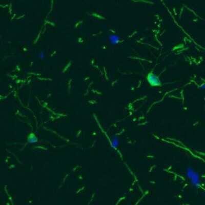 Immunohistochemistry: CNPase Antibody (CL2871) [NBP2-46635]