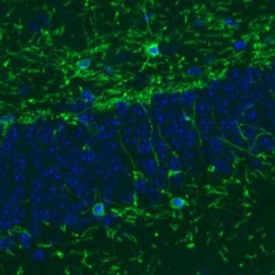 Immunohistochemistry: CNPase Antibody (CL2871) [NBP2-46635]