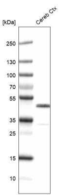 Western Blot: CNPase Antibody (CL2871) [NBP2-46635]