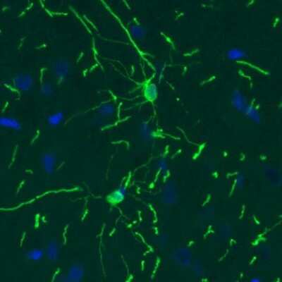 Immunohistochemistry: CNPase Antibody (CL2887) [NBP2-46617]