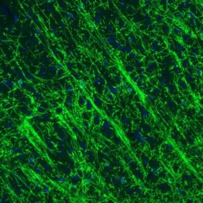 Immunohistochemistry: CNPase Antibody (CL2887) [NBP2-46617]