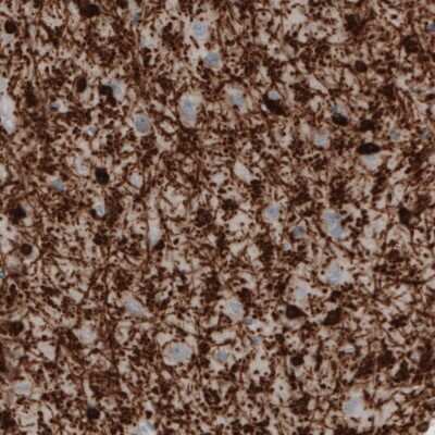 Immunohistochemistry-Paraffin: CNPase Antibody (CL2887) [NBP2-46617]
