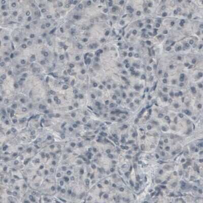 Immunohistochemistry-Paraffin: CNPase Antibody (CL2887) [NBP2-46617]