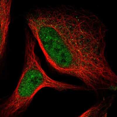 Immunocytochemistry/ Immunofluorescence: CNPase Antibody [NBP1-85999]