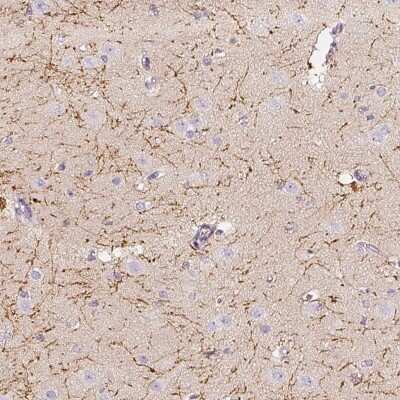 Immunohistochemistry-Paraffin: CNPase Antibody [NBP1-85995]