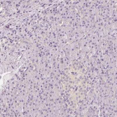 Immunohistochemistry-Paraffin: CNPase Antibody [NBP1-85995]