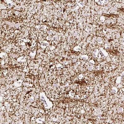 Immunohistochemistry-Paraffin: CNPase Antibody [NBP1-85997]