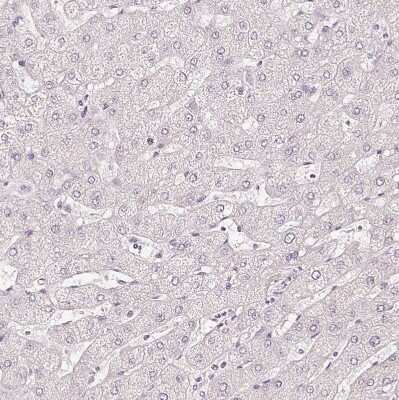 Immunohistochemistry-Paraffin: CNPase Antibody [NBP1-85997]