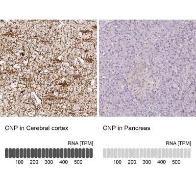 Immunohistochemistry-Paraffin: CNPase Antibody [NBP1-85997]