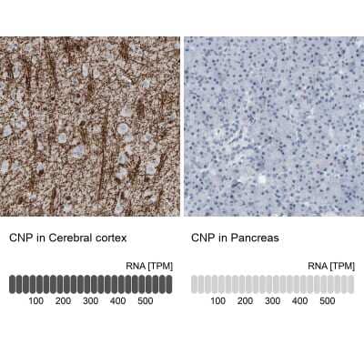 Immunohistochemistry-Paraffin: CNPase Antibody [NBP1-85999]