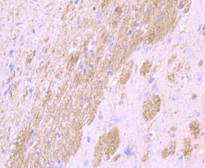 Immunohistochemistry-Paraffin: CNPase Antibody (JF10-25) [NBP2-66986]