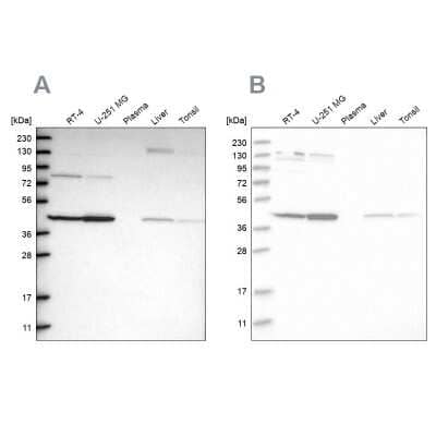 Western Blot: CNPase Antibody [NBP1-85995]